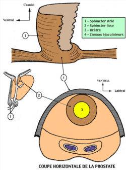 cancer-prostate-1